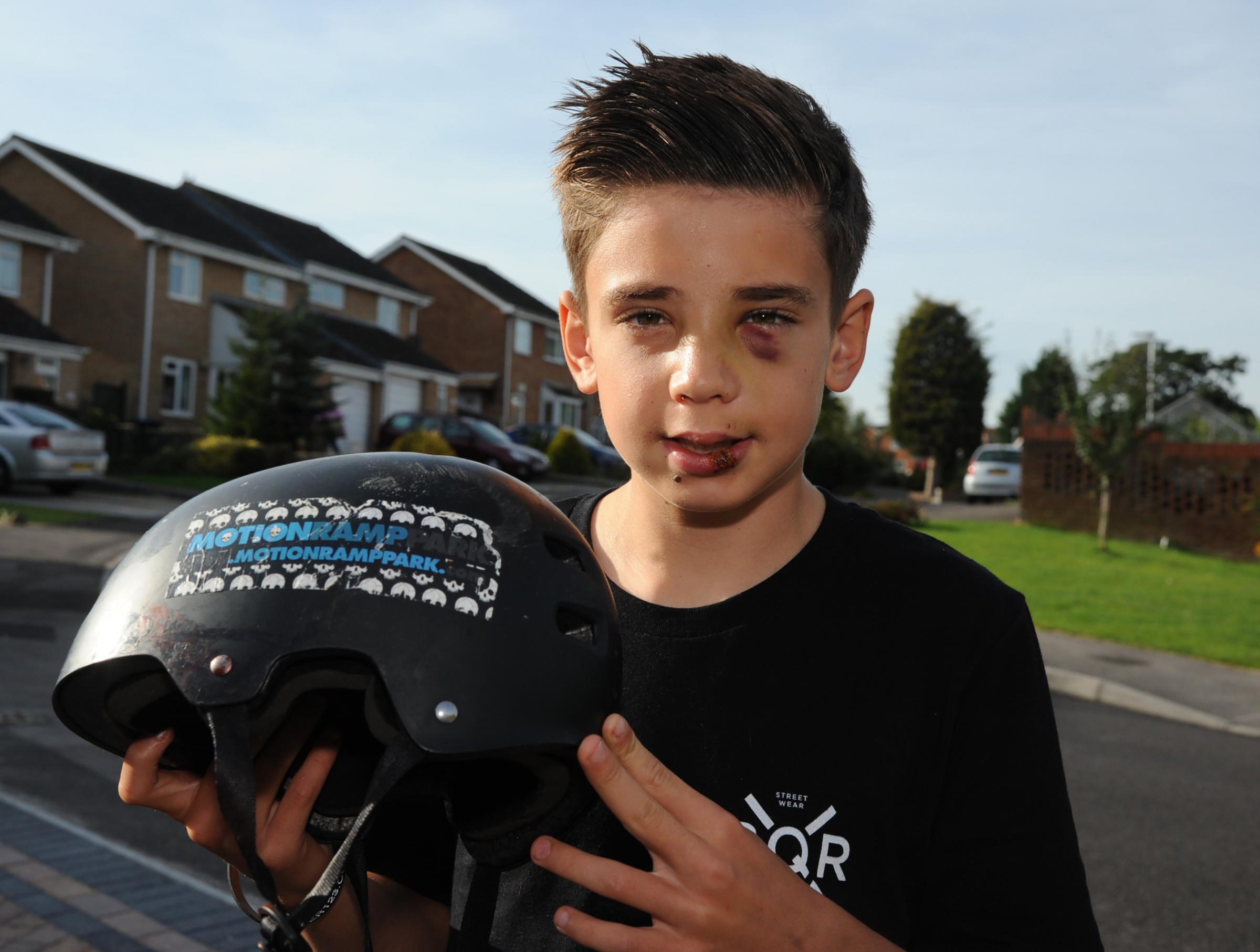 cool bmx helmets